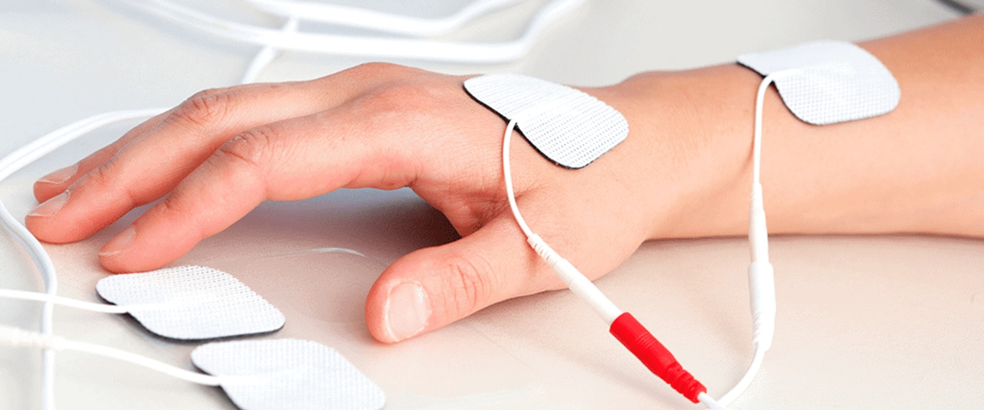 Understanding Iontophoresis Therapy for Sweat Management