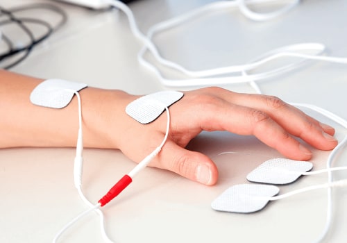 Understanding Iontophoresis Therapy for Sweat Management