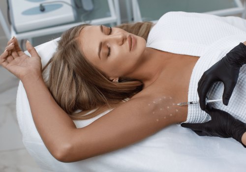 Laser Treatment for Hyperhidrosis: A Comprehensive Guide